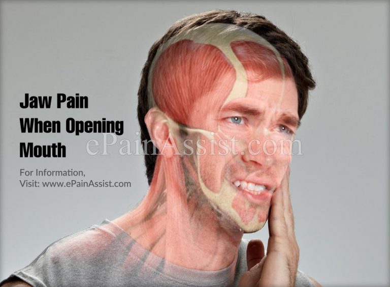 Jaw Pain When Opening Mouth: Symptoms, Causes, Treatments