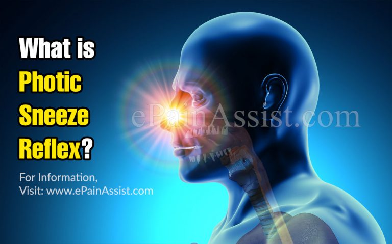 Photic Sneeze Reflex: Why Does It Happen & How to Treat Sun Sneezing?