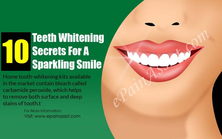 10 Teeth Whitening Secrets For A Sparkling Smile