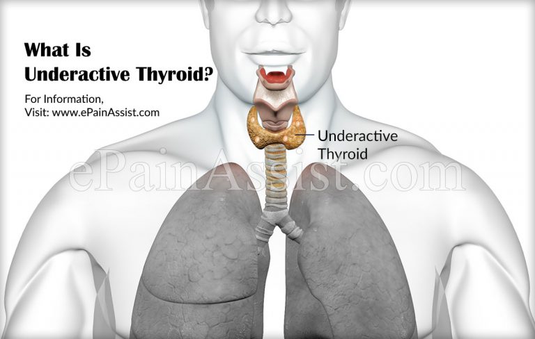 Underactive Thyroid Symptoms: What Happens If You Have An Underactive Thyroid?
