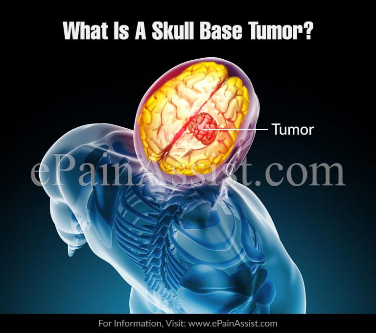 What Are The Presenting Features Of Malignant Skull Base Tumor?