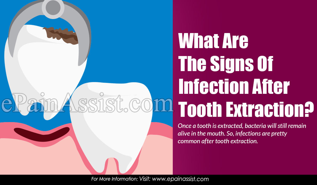 What Are The Signs Of Infection After Tooth Extraction? What Are The Signs Of Infection After Tooth Extraction?