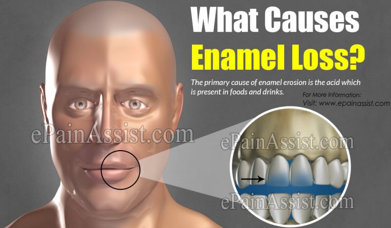 10 Startling Causes of Enamel Loss