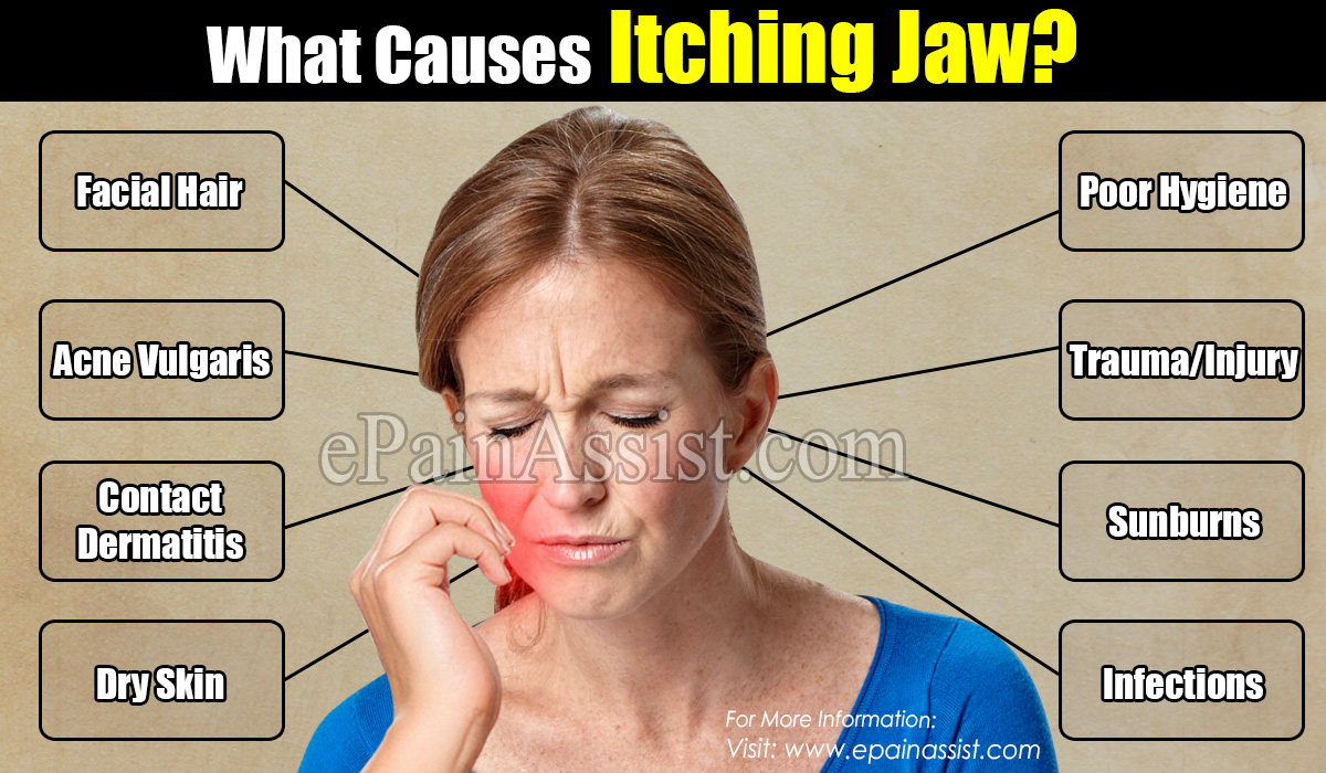 What Causes Itching Jaw?