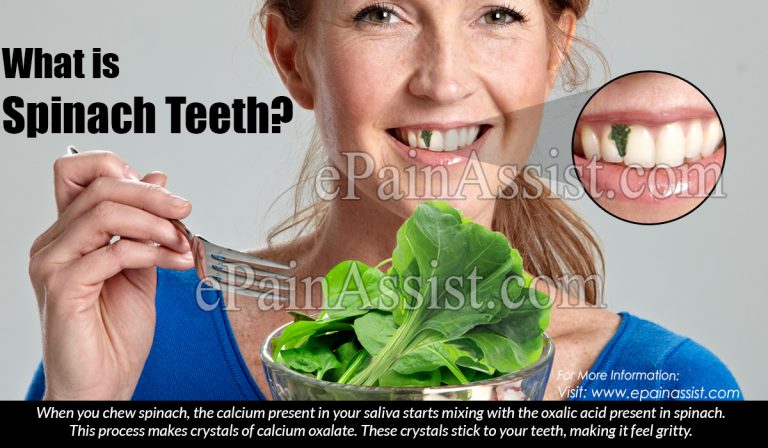 What is Spinach Teeth?