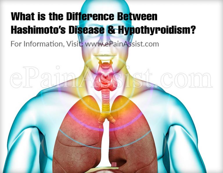 What is the Difference Between Hashimoto’s Disease & Hypothyroidism?
