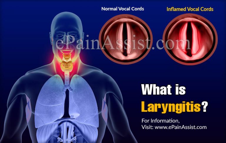 What Is Worse Pharyngitis Or Laryngitis?