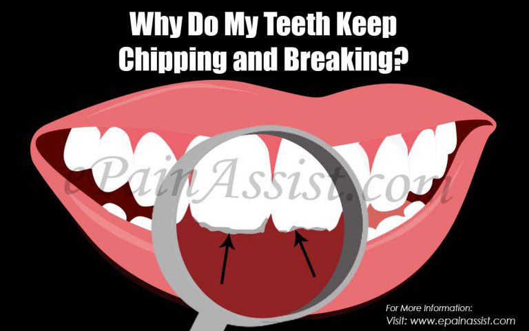 Why Do My Teeth Keep Chipping and Breaking & What Can Be Done About It?