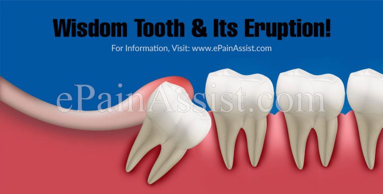 Wisdom Tooth & Its Eruption: Symptoms and Treatments