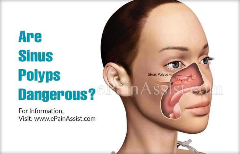 Are Sinus Polyps Dangerous & Can They Turn Into Cancer?