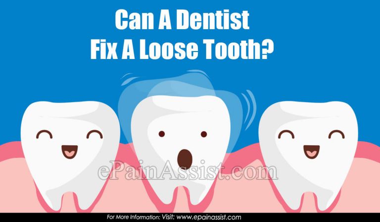 Can A Dentist Fix A Loose Tooth?