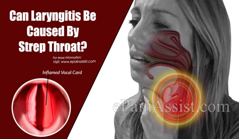 Can Laryngitis Be Caused By Strep Throat?