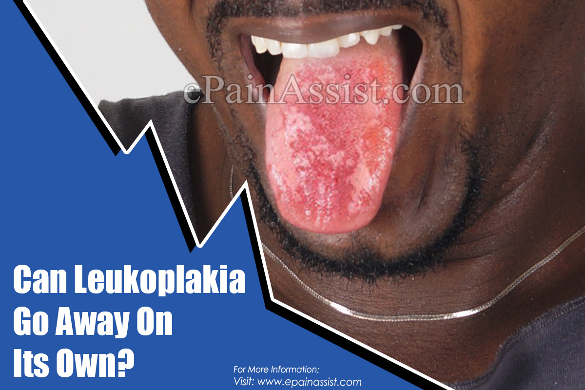 Can Leukoplakia Go Away On Its Own?