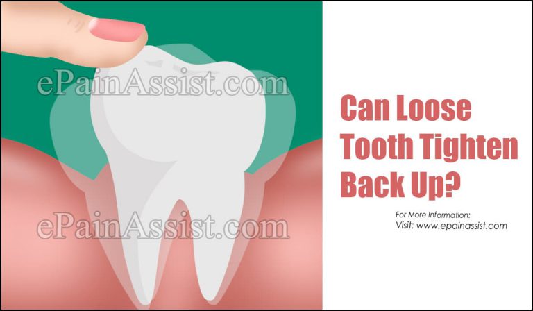 Can Loose Tooth Tighten Back Up?