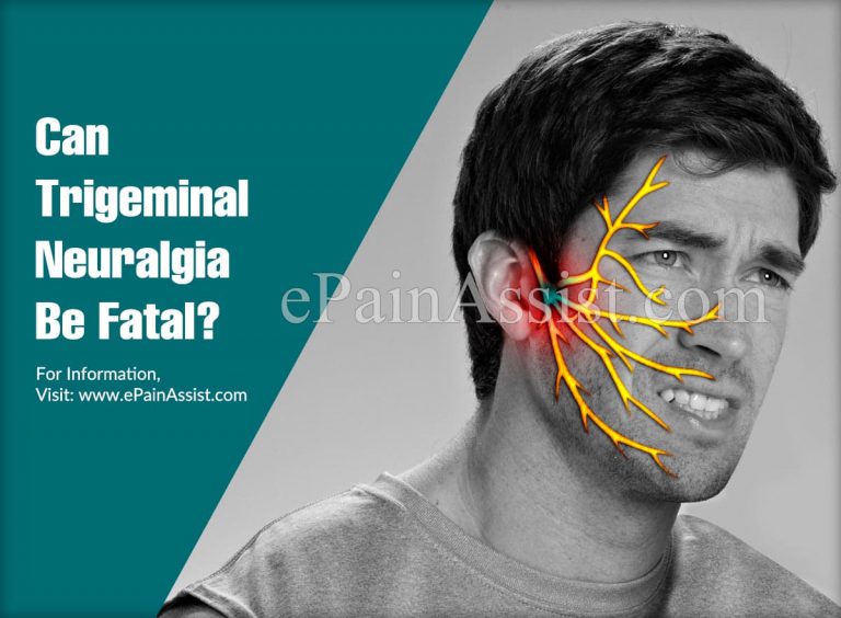 Can Trigeminal Neuralgia Be Fatal & How Painful Is Trigeminal Neuralgia?