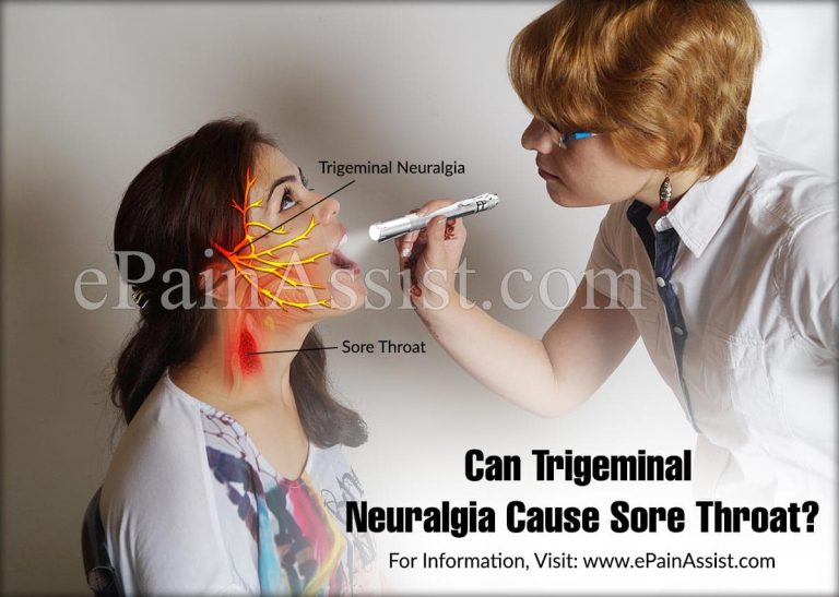 Can Trigeminal Neuralgia Cause Sore Throat?
