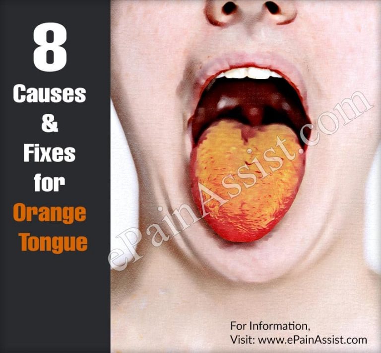 8 Causes & Fixes for Orange Tongue