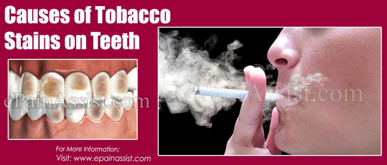 Causes of Tobacco Stains on Teeth & Home Remedies to Get Rid of Them