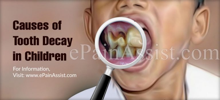 Causes of Tooth Decay in Children & Ways to Protect Teeth From Cavities| Does Fluoride Toothpaste Help Prevent Dental Cavities?