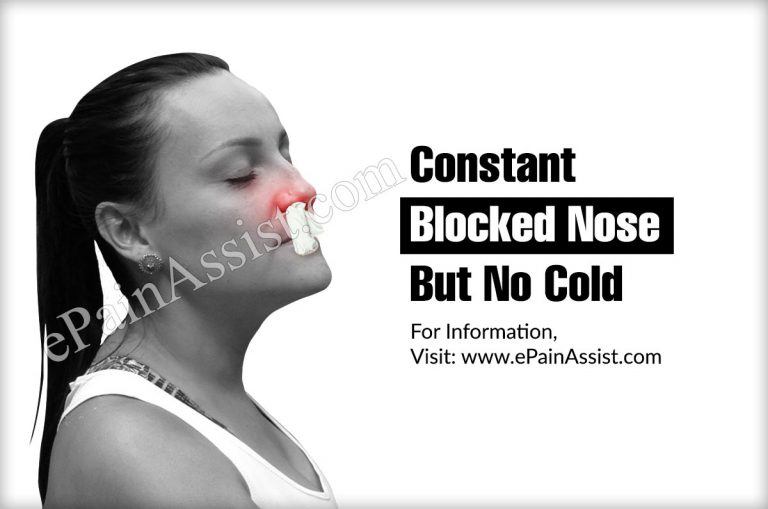 Constant Blocked Nose But No Cold