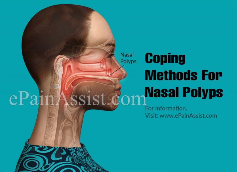 Coping Methods For Nasal Polyps