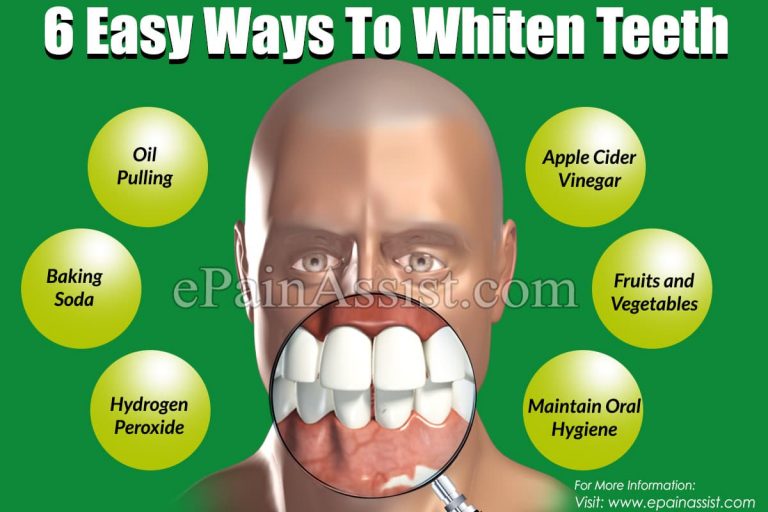 Easy Ways To Whiten Teeth