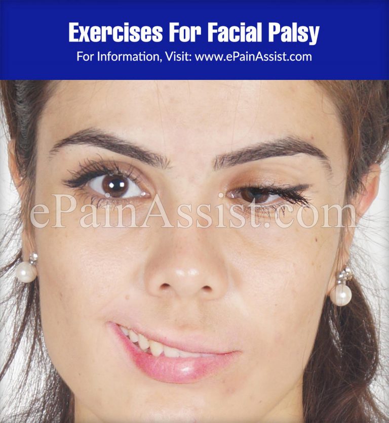 Exercises For Facial Palsy