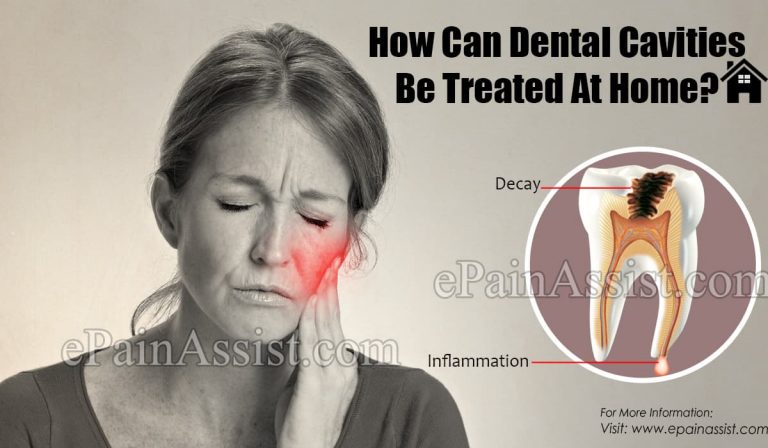 How Can Dental Cavities Be Treated At Home?