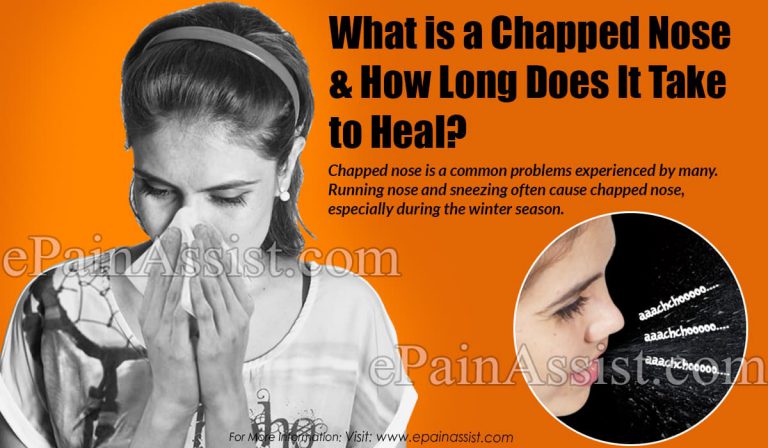 How Long Does Chapped Nose Take to Heal & What are Its Home Remedies?