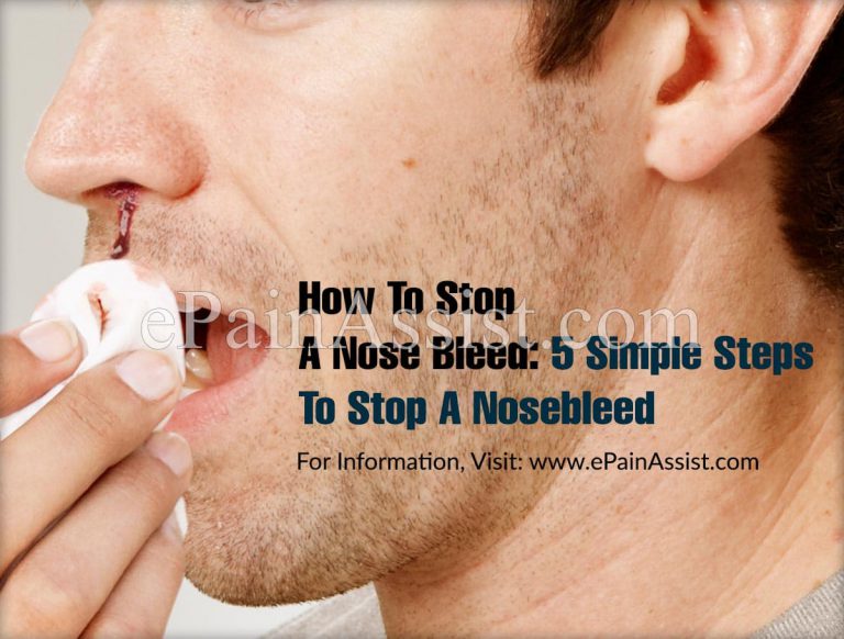 How To Stop A Nose Bleed : 5 Simple Steps To Stop A Nosebleed