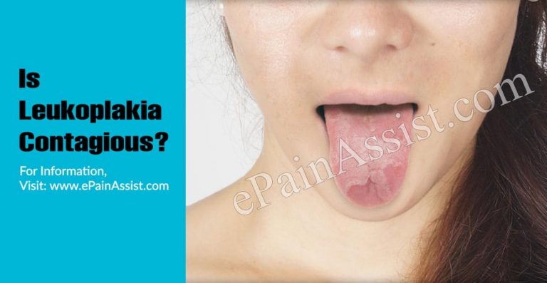 Is Leukoplakia Contagious?