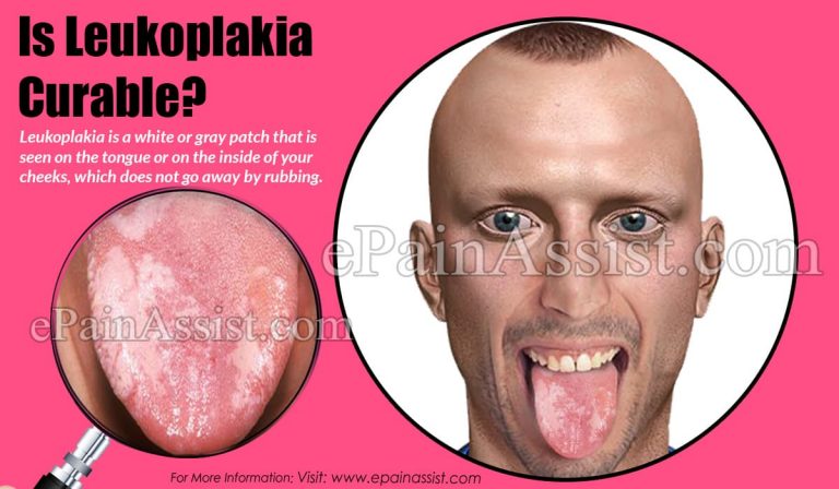Is Leukoplakia Curable?