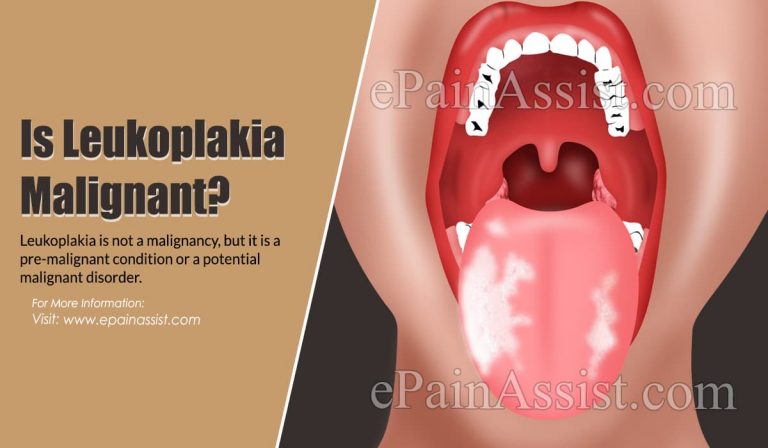 Is Leukoplakia Malignant?
