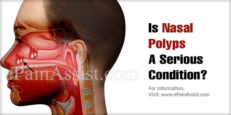 Is Nasal Polyps A Serious Condition & Can It Be Reversed?