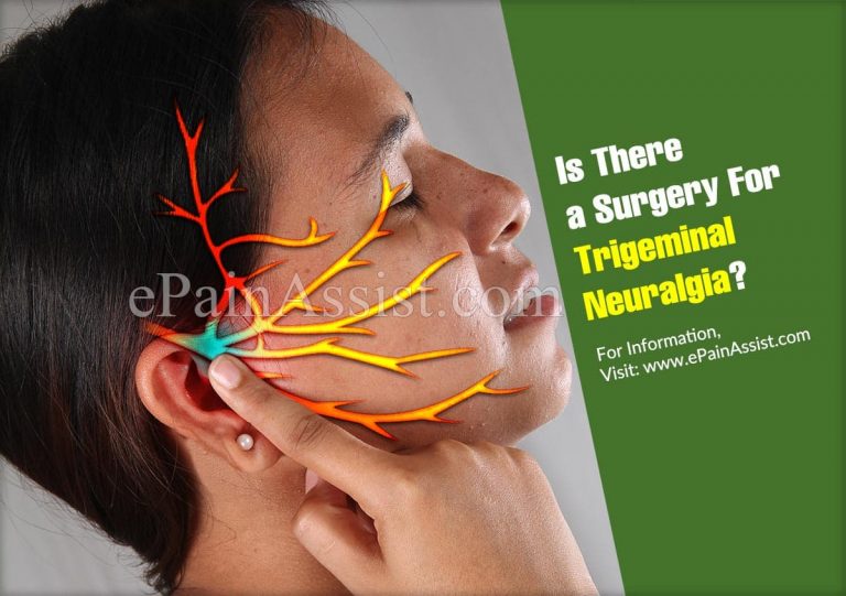 Is There a Surgery For Trigeminal Neuralgia?