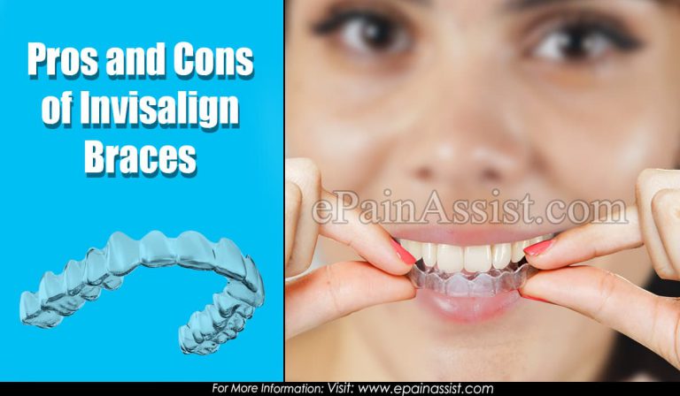 Pros and Cons of Invisalign Braces