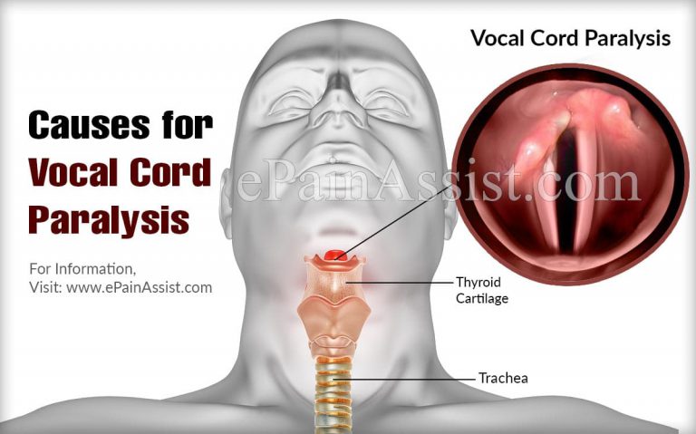 Risk Factors, Complications & Treatment of Vocal Cord Paralysis