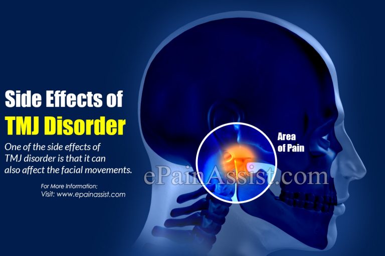 Side Effects of TMJ Disorder & Its Home Remedies