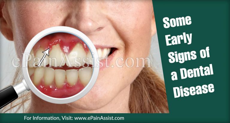 Some Early Signs of a Dental Disease