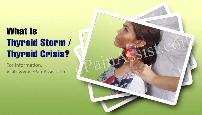 Thyroid Storm or Thyroid Crisis: Causes, Symptoms, Treatment, Prognosis, Prevention, Diagnosis
