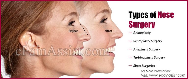 Types of Nose Surgery