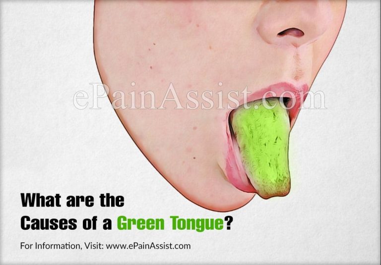 What are the Causes of a Green Tongue, Know its Treatment, Complications, Prognosis