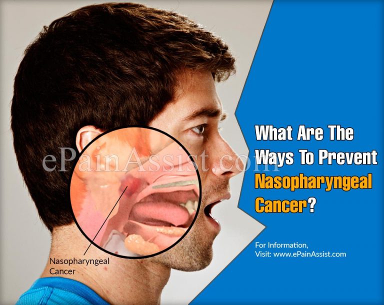 What Are The Ways To Prevent Nasopharyngeal Cancer & Does It Reoccur?
