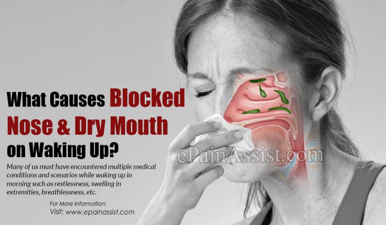 What Causes Blocked Nose & Dry Mouth on Waking Up?