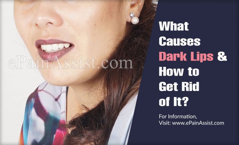 What Causes Dark Lips & How to Get Rid of It?