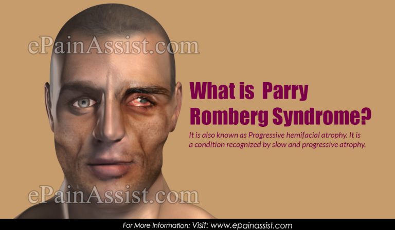 What is Parry Romberg Syndrome: Causes, Symptoms, Treatment, Prognosis, Diagnosis