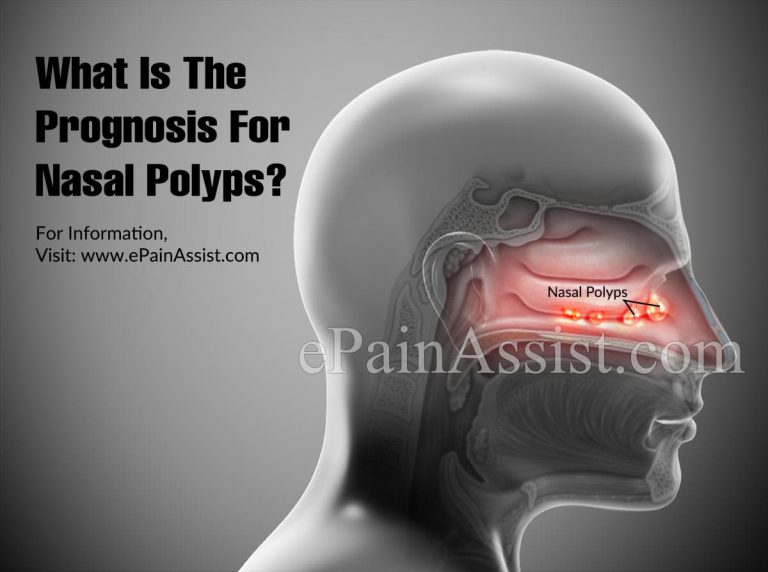 What Is The Prognosis For Nasal Polyps?