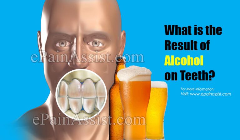 What is the Result of Alcohol on Teeth?