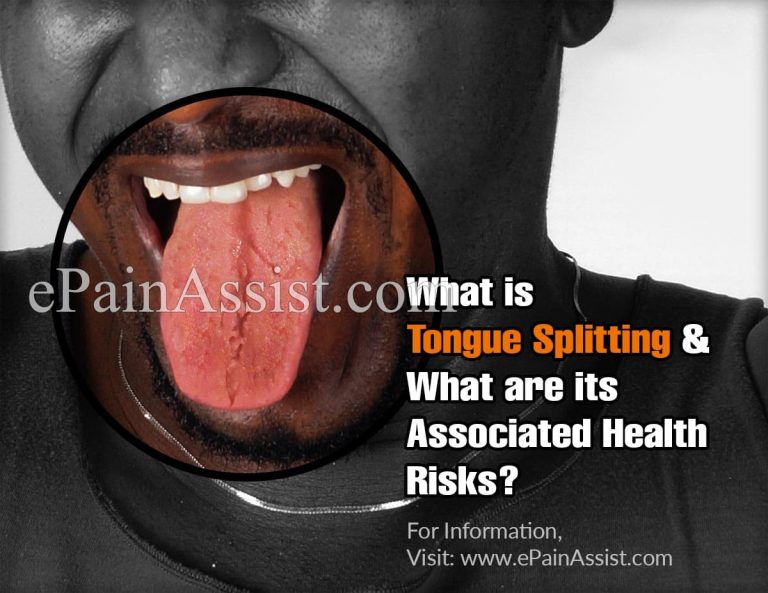 What is Tongue Splitting & What are its Associated Health Risks?|How is Tongue Splitting Done?