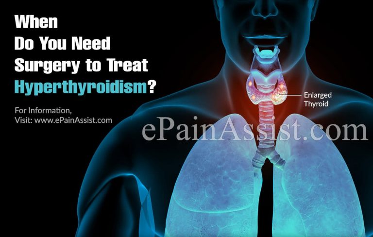 When Do You Need Surgery to Treat Hyperthyroidism?
